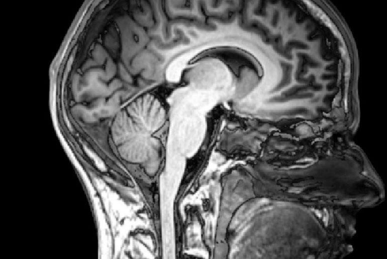 機械学習が命を救うテクノロジーへ――医療を変革するAIの最前線