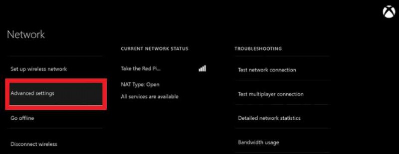 DNS が Xbox サーバー名を解決しない場合の 5 つの最適な修正方法